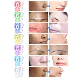 Masque de luminothérapie LED pour le visage et le cou Hilmana